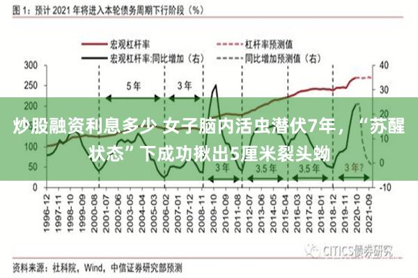 炒股融资利息多少 女子脑内活虫潜伏7年，“苏醒状态”下成功揪出5厘米裂头蚴